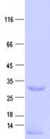Human NAT1 / AAC1 Protein (Recombinant His, N-Terminal)