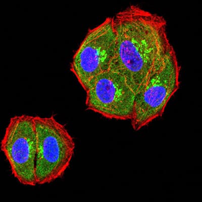 Monoclonal Mouse anti-Human HAVCR2 / TIM-3 Antibody (clone 7C8A7, IHC, WB)