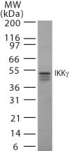 IHC-plus™ IKBKG / NEMO / IKK Gamma Antibody (clone 46B844)