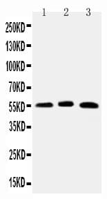 Polyclonal Rabbit anti-Human ONECUT1 / HNF6 Antibody (aa187-203, IHC, WB)