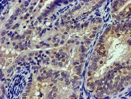 CAPN9 / Calpain 9 Antibody (clone OTI2G1)