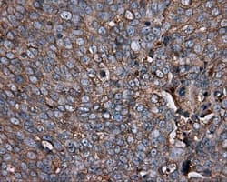 PIM2 / Pim-2 Antibody (clone OTI5D5)