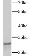 CD8A / CD8 Alpha Antibody