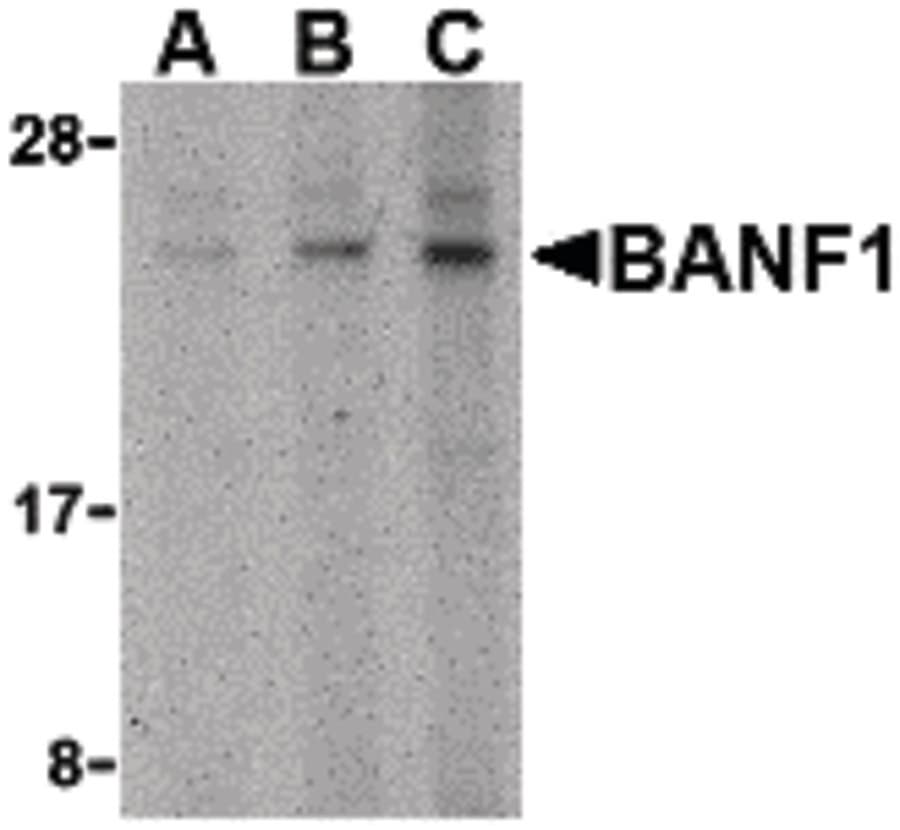 IHC-plus™ BANF1 / BAF / BCRP1 Antibody