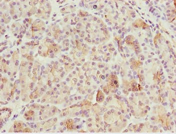 Polyclonal Rabbit anti-Human BNIP1 Antibody (IHC)