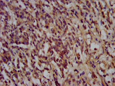 Polyclonal Rabbit anti-Human NANS Antibody (IF, WB)