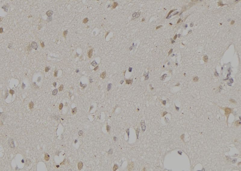 NCF2 / NOXA2 / p67phox Antibody