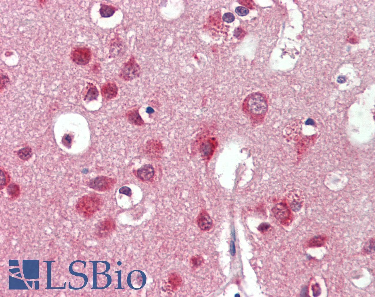 IDS / Iduronate 2 Sulfatase Antibody (aa154-203)