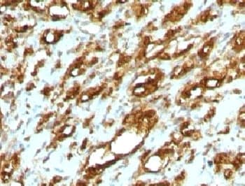Muscle Actin Antibody (clone MSA/953)