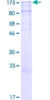 Human RTN4 / Nogo Protein (Recombinant GST)