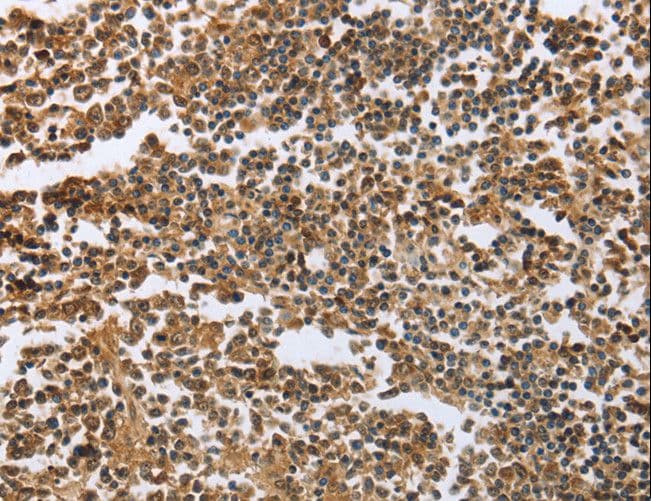 Polyclonal Rabbit anti-Human ECE-1 Antibody (IHC)
