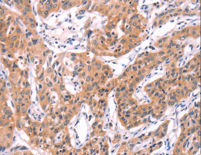 SERPINA5 / PCI Antibody
