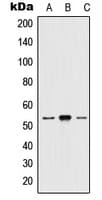 HTR2A / 5-HT2A Receptor Antibody (N-Terminus)