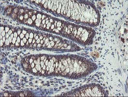GCP60 / ACBD3 Antibody (clone OTI3A1)