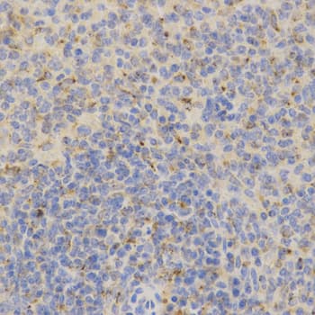 Polyclonal Rabbit anti-Human PSAP / Prosaposin Antibody (IHC, IF, WB)