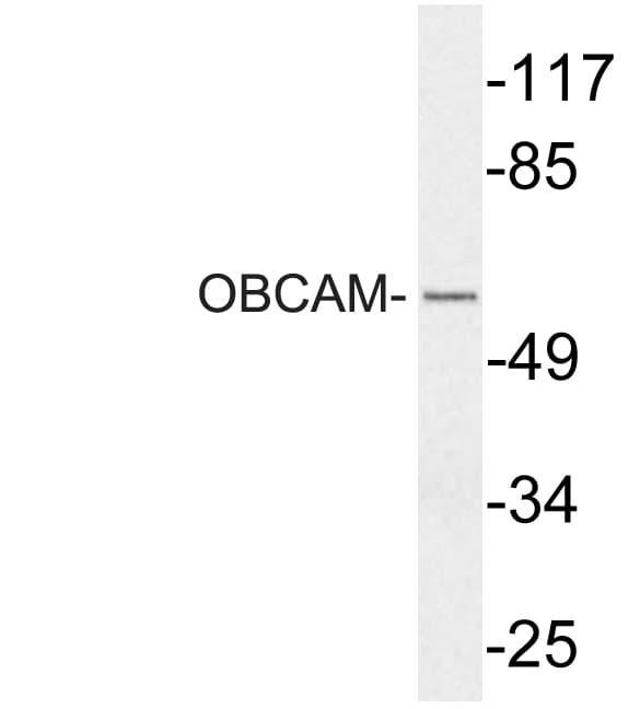 OPCML / OBCAM Antibody (aa152-201)