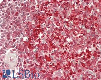 IHC-plus™ Polyclonal Rabbit anti-Human PPM1G Antibody (aa400-450, IHC, WB)