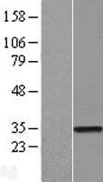ZNF323 Protein (Over-Expression Lysate Myc-DDK (Flag))