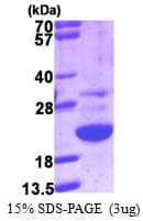 Human LGALSL / Galectin 5 Protein (Recombinant His)
