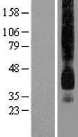 SLC2A1 / GLUT-1 Protein (Over-Expression Lysate Myc-DDK (Flag))