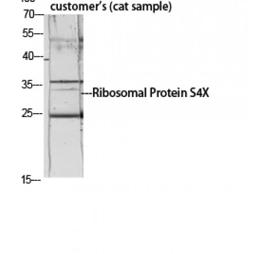 RPS4X + RPS4Y1 + RPS Antibody (50-130 aa, Internal)