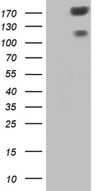 DMN / Desmuslin / Synemin Antibody (aa329-580, clone OTI3D10)