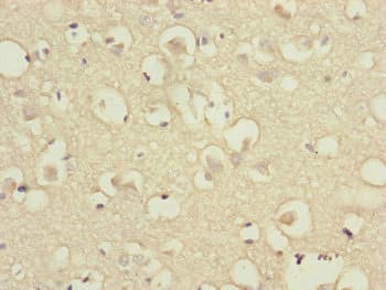 DSN1 Antibody