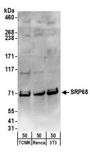 IHC-plus™ Polyclonal Rabbit anti-Human HUPF2 / UPF2 Antibody (aa1-50, IHC, WB)