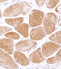 Polyclonal Rabbit anti-Human PRKAA1 / AMPK Alpha 1 Antibody (IHC, WB)