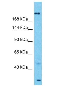 SPTA1 / Alpha Spectrin Antibody (aa380-429)