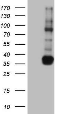 TACC2 Antibody (aa727-1026, clone OTI2G3)