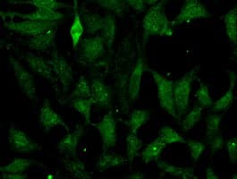Monoclonal Mouse anti-Human FH / Fumarase / MCL Antibody (clone OTI2A2, IF, WB)