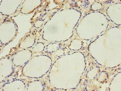 ACAA1 Antibody (aa27-331)