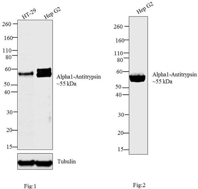 SERPINA1 / Alpha 1 Antitrypsin Antibody (clone TMF1#4B5)