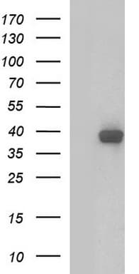 SHBG Antibody (clone OTI1E7)