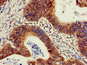 PIK3R2 / p85 Beta Antibody