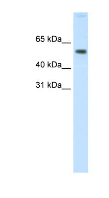 AKT1 Antibody (aa121-170)
