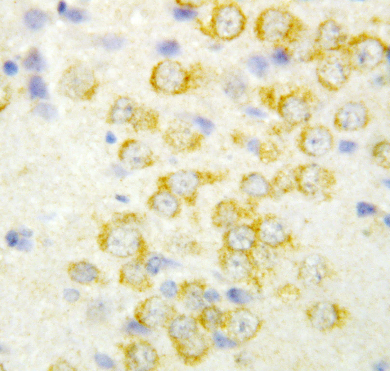 FGF9 Antibody (aa150-164)