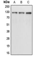 NEP / DDR1 Antibody (Internal)