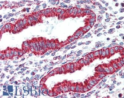 IHC-plus™ Polyclonal Rabbit anti-Human NDUFA4L2 Antibody (74-87 aa, C-terminal, IHC, WB)