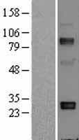 Human Adiponectin Protein (Over-Expression Lysate Myc-DDK (Flag))