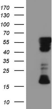 RIPK3 / RIP3 Antibody (aa233-518, clone OTI2C11)