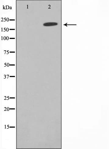 MAST205 / MAST2 Antibody