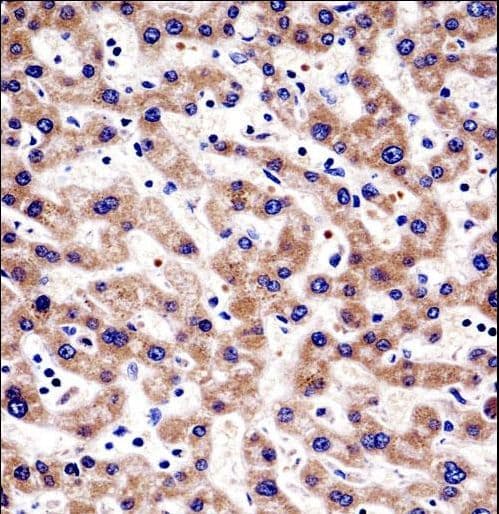 Polyclonal Rabbit anti-Human TIP30 / HTATIP2 Antibody (aa45-74, IHC, WB)