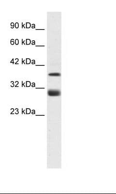 Polyclonal Rabbit anti-Human TAL1 Antibody (Biotin, aa236-285, IHC, WB)