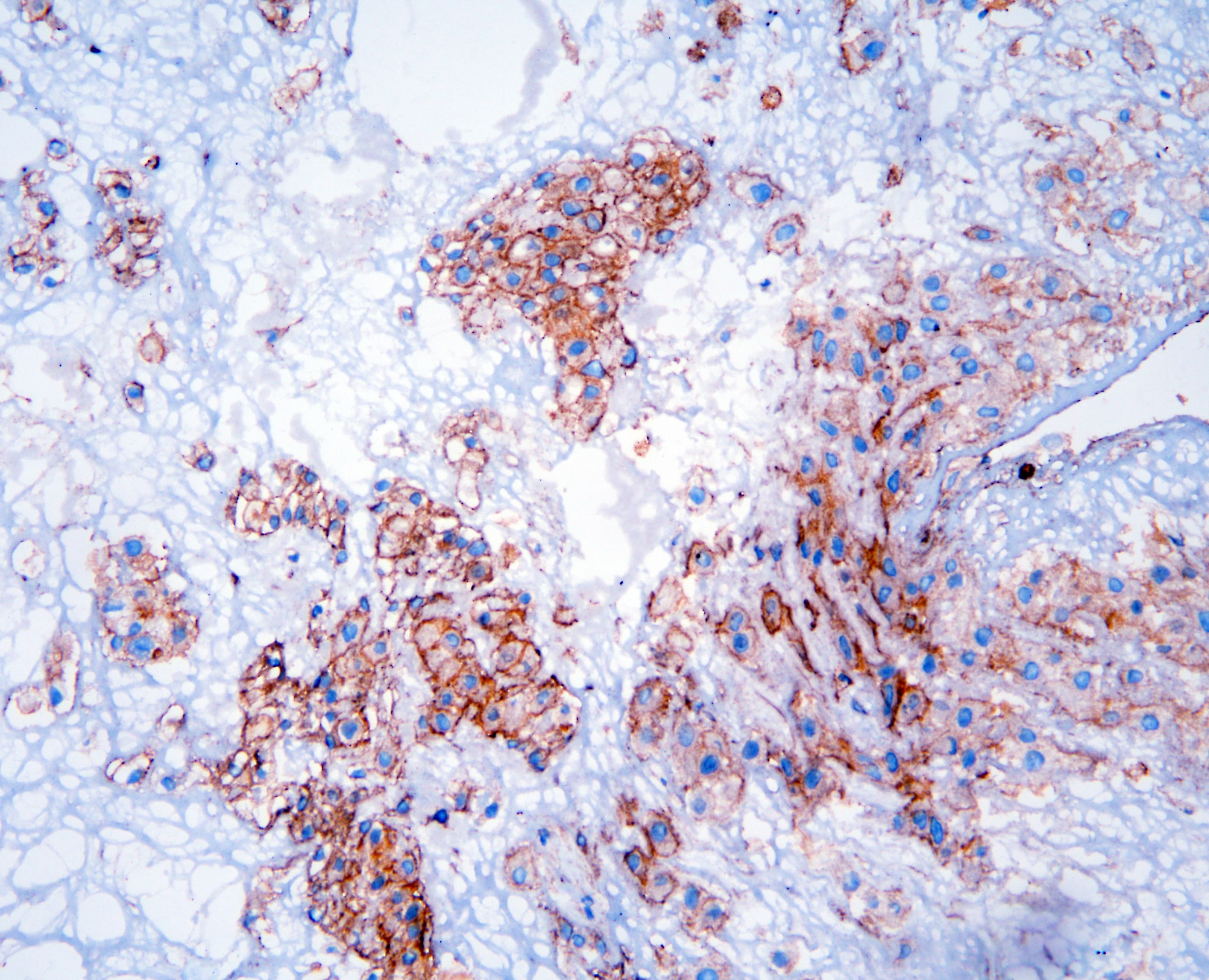 Polyclonal Rabbit anti-Human GNB1 Antibody (IHC, WB)