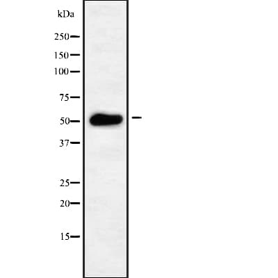 TBL2 Antibody