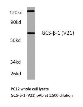Polyclonal Rabbit anti-Human GUCY1B3 Antibody (Val21, IHC, WB)