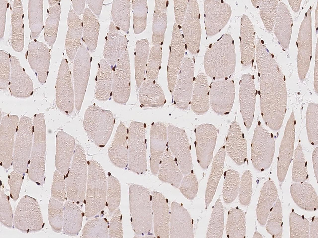 CUTC Antibody