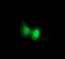 RAB21 Antibody (clone OTI6A9)